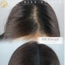 하이테크닉 이미지