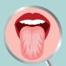 서울바른강치과의원 | 입 냄새의 진짜 원인은 ‘치아’가 아닐 수도 있습니다 (서울바른강치과) [천호치과]