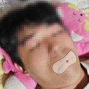 바른 수면 | 입벌림방지밴드 입안건조 홈케어 바른수면밴드 사용 후기