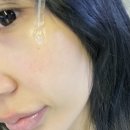 위드메디칼 | 건성피부 진정세럼 추천 위드유스킨 편백수 시카세럼