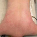 세븐일레븐 광양중마대로점 | 광양 중마동 피부관리 리프팅관리 인비덤기기 등관리 후기