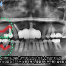 좌동로 93 네이버블로그