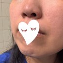 와이트리 듀이패드 사용후기 | 수부지 피부 추천 토너 패드