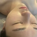 루비스킨케어 이미지