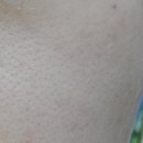 화이트필의원 이미지