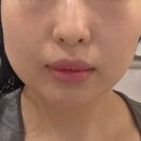 뷰티플페이스 | [잠실새내] 오늘뷰티｜두피부터 끌어올리는 풀페이스 리프팅 관리 후기