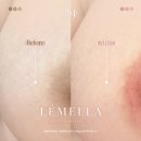 미르플랜 이미지