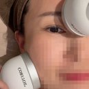 둔산동 ST타워 | 대전 스노우의원 더톡신 보톡스 기록 (내돈내산)