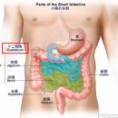 십이지장암 소장암의 증상 그리고 예방법 알아보기 이미지