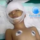 샤키 이미지