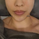 수앤미스킨케어 | 동탄에스테틱 반송동피부관리 잘하는 수앤미에스테틱 쿠마사인 리프팅 솔직후기