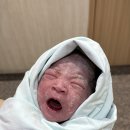 [뽀물이 출산일기 #2] 광주 에덴병원 제왕절개 후기 : 전치태반 역아 수술 후 회복일기