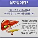 소화기 질환과 비슷한 '담도암 초기 증상' 이미지