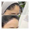 클레르 피부샵 네이버블로그