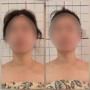 하이바디 | 마곡 하이에스테틱 인디바 바디관리 솔직 후기