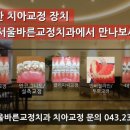 서울바른정치과 이미지