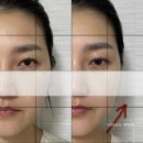 피닉스시스템 이미지