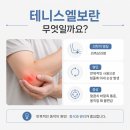 재택근무 늘어난 후 팔꿈치 외측 통증 지속적인 신호가?