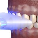 서울새로이치과의원 이미지