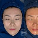 나예스킨 | 슈젝홈키트 가격비교와 한달 관리 후기