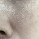 (주)슈퍼애시드 | 피부하얘지는크림 졸로픽스 민타비20, 논크림 실제사용후기