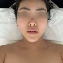 동성로 관광안내소 | 대구 윤곽관리 잘하는곳｜작은얼굴 케어로 라인 정리된 유에보 에스테틱 후기