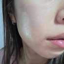 뷰티스템셀의원 | 피부 푸석할 때 쓰고 있는 PDRN 앰플, 선스킨 스템셀 앰플 후기