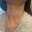 타임리턴의원 | 관리 : 넥라인 보톡스 : 밴스청담에서 슬림넥 관리 받은 후기 : 웨딩 1개월 전에는 필수인가 : 청담동 관리