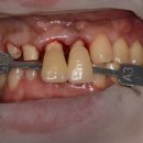 신세계치과기공소 이미지