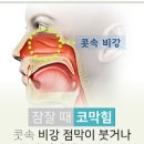 비인두암 과 원인 그리고 이미지