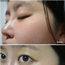 ㈜코아이비 | 피부탄력 및 홍조개선의 효과를 경험하신 고객님의 사용인터뷰입니다.