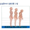 골다공증...골다공증 막는 푸드테라피 이미지