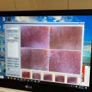 엠 더블류 | 대구 비텐에스테틱 본점 | 모공완전청소케어 찐 후기