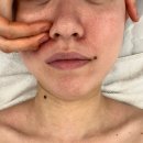 달뜰목 | 평택웨딩관리 뜰에스테틱 본점, 1회 관리로도 라인 정리 확실했던 평택윤곽관리 후기