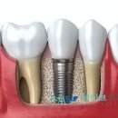 세이브치과의원 이미지