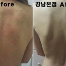 리유한의원 네이버블로그