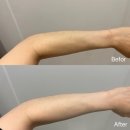 탠바디왁싱 | 파주태닝 추천 운정 탠바디왁싱&태닝 웨딩 촬영 전 화이트태닝 후기, 1회만에 탄자국 복구가 가능하다...