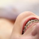 베네치아치과의원 이미지