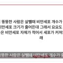 진수 비만세포 스핀 보고 궁금해짐 이미지