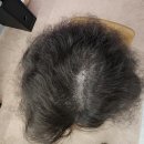 분당-2 | 분당두피관리 분당탈모관리 머리숱관리 닷포유 용인분당점 2회차 후기