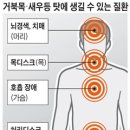 거북목·새우등 자세, 놔두면 치매나 변비 생길 수도 이미지