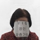 대구 정수리가발 후기ㅣ60대 여성 정수리 탈모, 볼륨까지 살린 맞춤 부분 가발