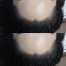 권헤어라인