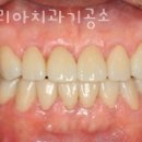 덴트리아치과기공소 이미지
