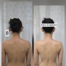 중촌동 맞춤거리 상점가 | 대전 중촌동 목 어깨 관리로 몸이 가벼워졌던 리턴뷰티 솔직 후기