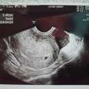 양지산부인과의원 이미지