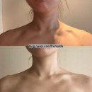 남앤욱카마스타 | [달서구바디관리/송현동수기관리/달서구예신관리] 화이팅바디앤스킨