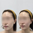 뽀독뽀독 | 위한 뷰티 | 대구 알테온 윤곽관리, 대구 윤곽 리프팅, 대구 북구 탄력관리, 칠곡 신부관리 에스테틱 추천