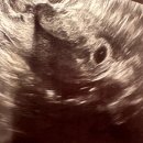 은하여성의원 이미지