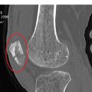 별별 벨소리 이미지
